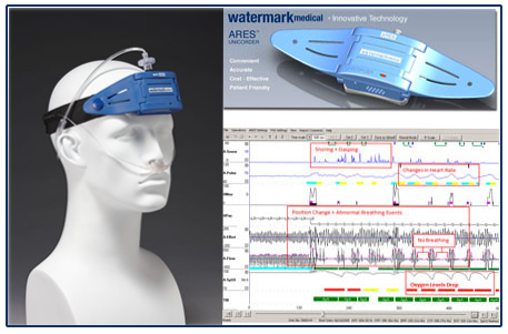  Eccovision Rhinometer and Pharyngometer 